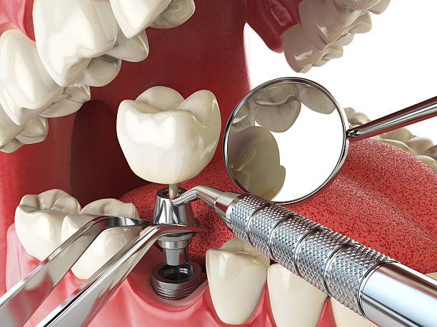 Best Emergency Dental Care for Sports Injuries in Willacoochee, GA